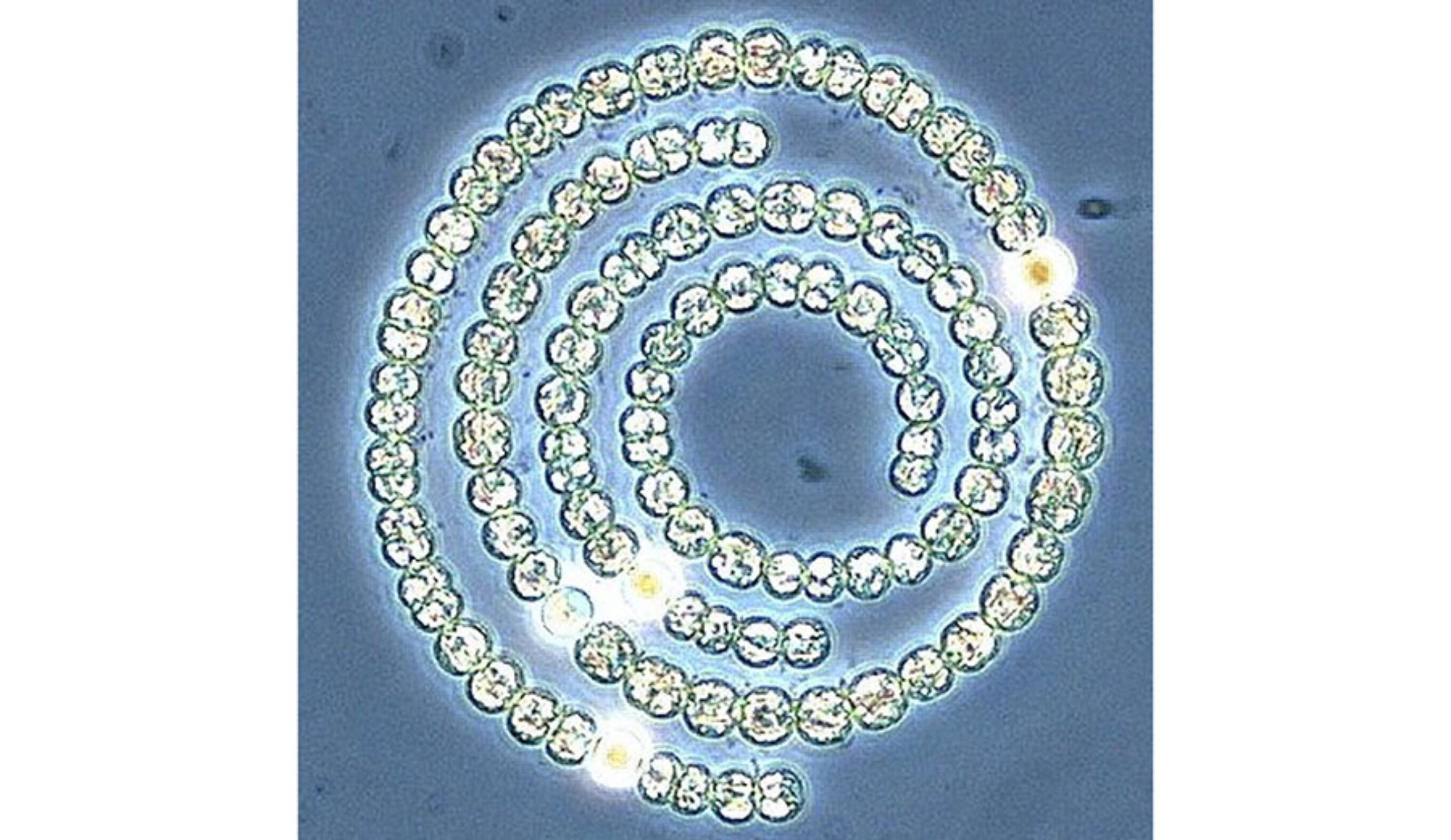 Cyanobacteria (blue-green algae) under a microscope