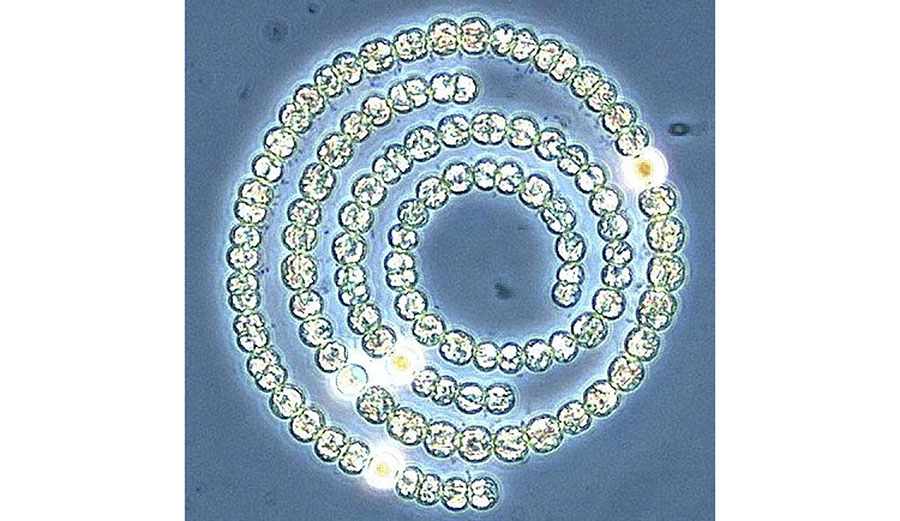 Cyanobacteria (blue-green algae) under a microscope