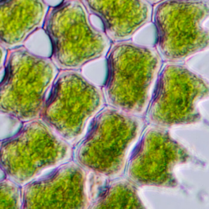 Phytoplankton under a microscope