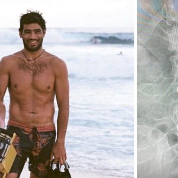 Ryan Moss with a photo of a broken back