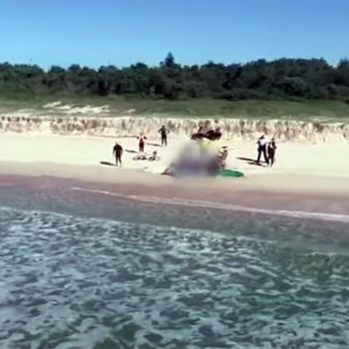 A shark attack victim