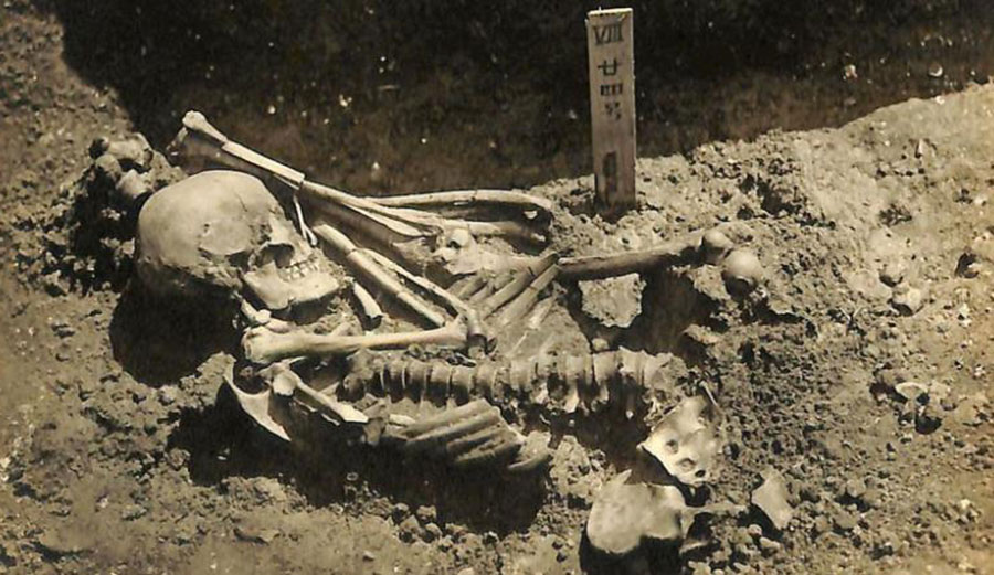 Shark attack victim in Japan