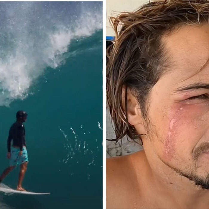 nic von rupp with tomcat bite