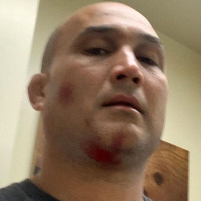 BJ Penn almost died in a wave pool