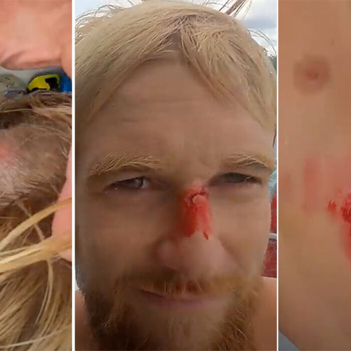 bloody surfers with Nic von Rupp