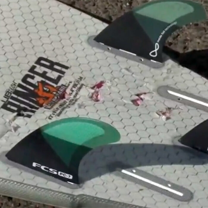 Northern California Surfer Survives Vicious Shark Attack