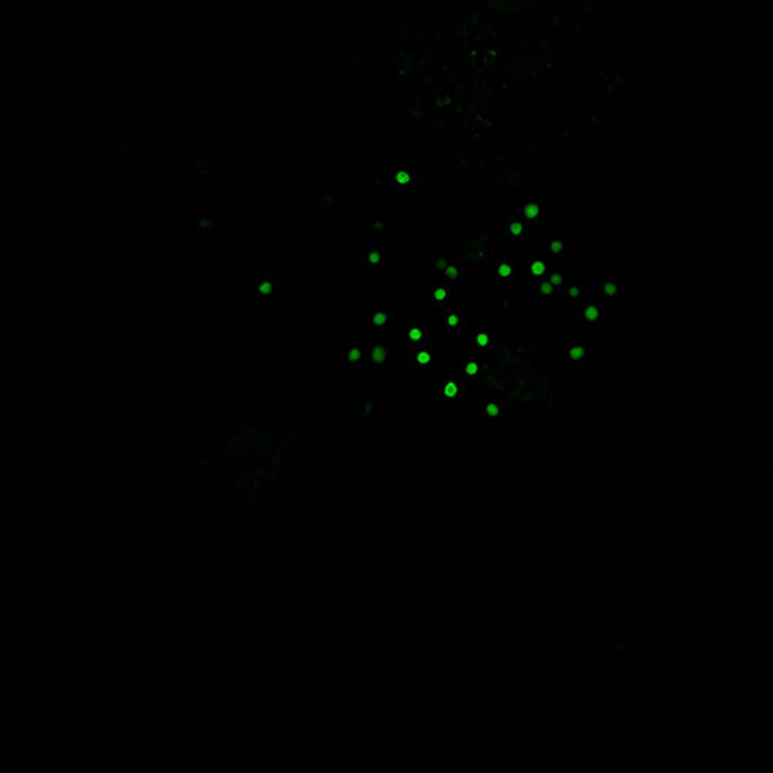 Phytoplankton