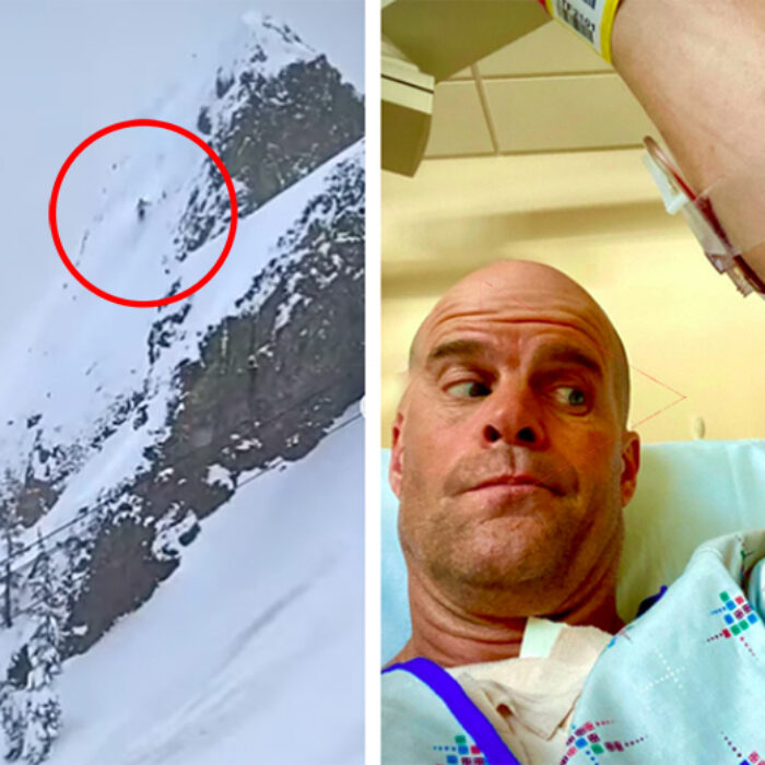Ski Filmmaker Scott Gaffney Takes Massive Tumble at Palisades; Breaks Scapula, Collapses Lung