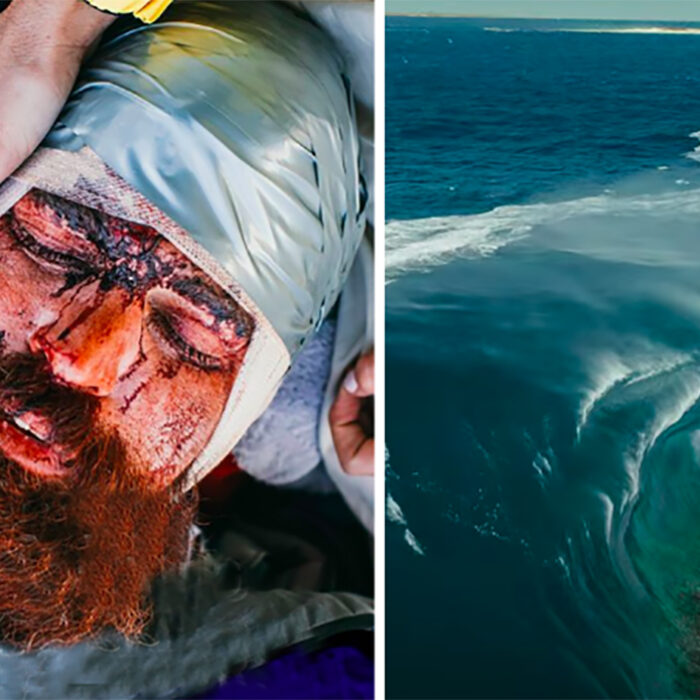 Catching Up With Mutant Slab-Slayer Kerby Brown After His Horrific Surfing Accident