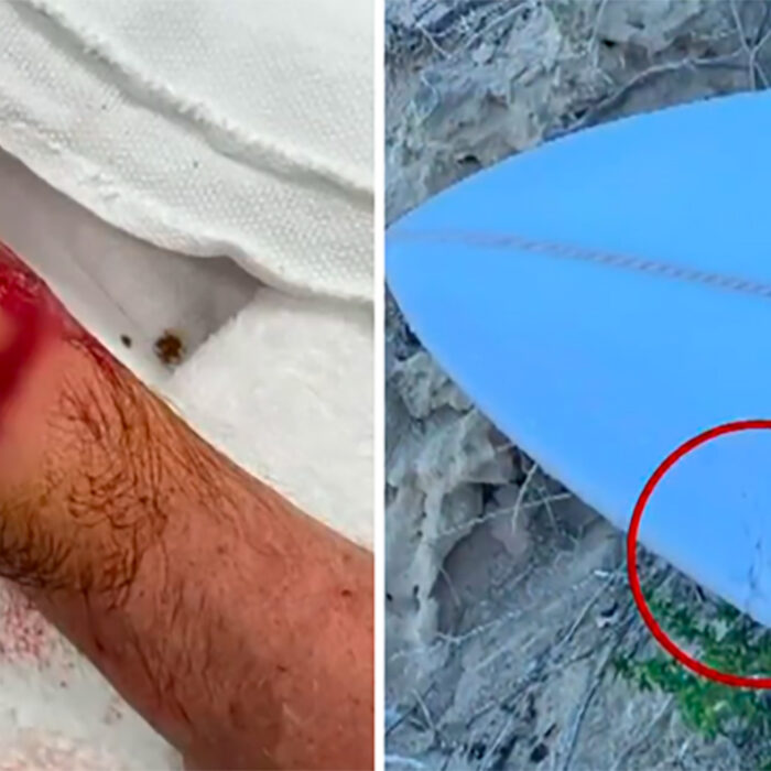 Surfer Attacked by Shark in Western Australia