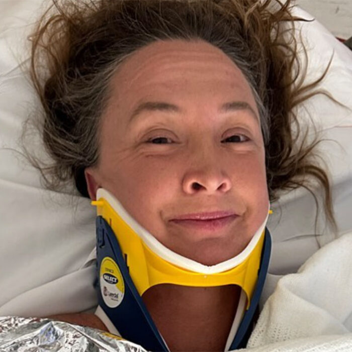 Brooke Hanson after surfing accident