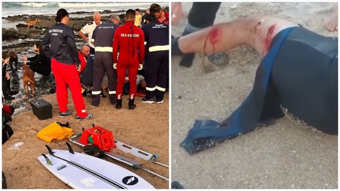 paramedics gather around a man with a sharkbite (left); the bite wounds (right)