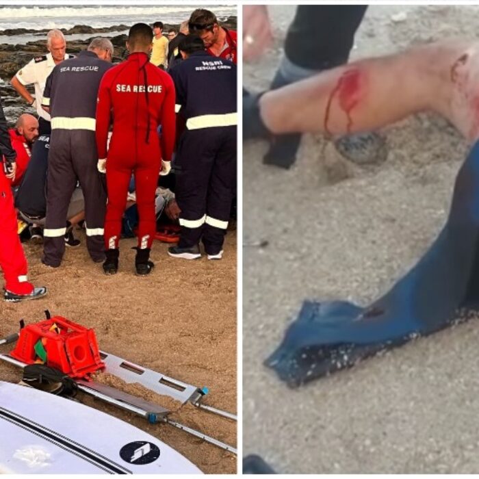 paramedics gather around a man with a sharkbite (left); the bite wounds (right)