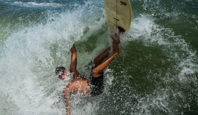 common surfing injuries