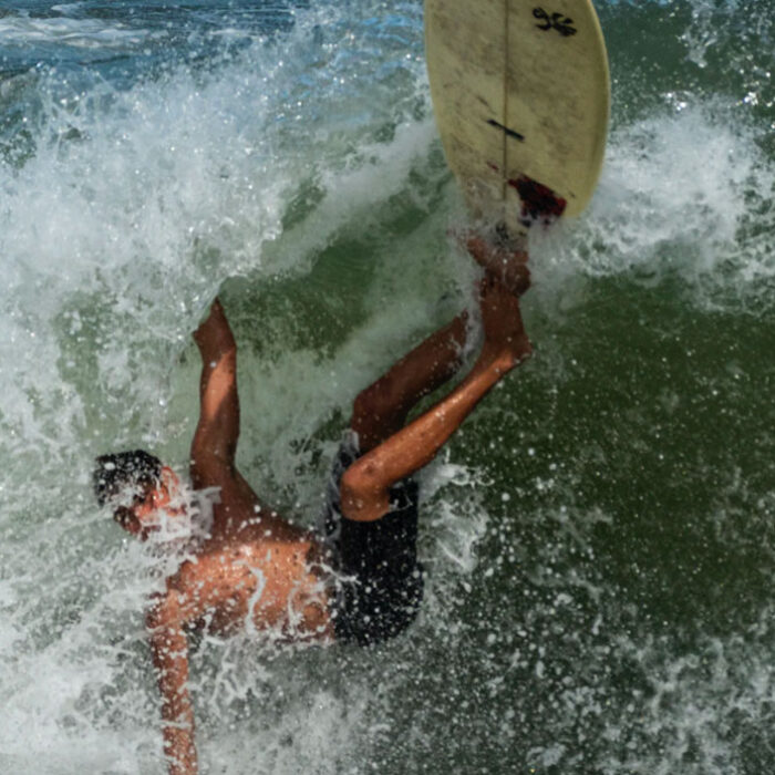 common surfing injuries