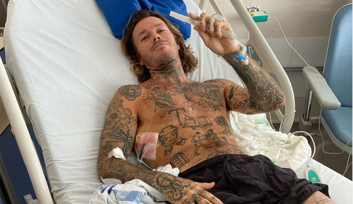 Tom Lowe Breaks 5 Five Ribs and Punctures Lung In Serious Teahupoo Wipeout - Vimarsana News