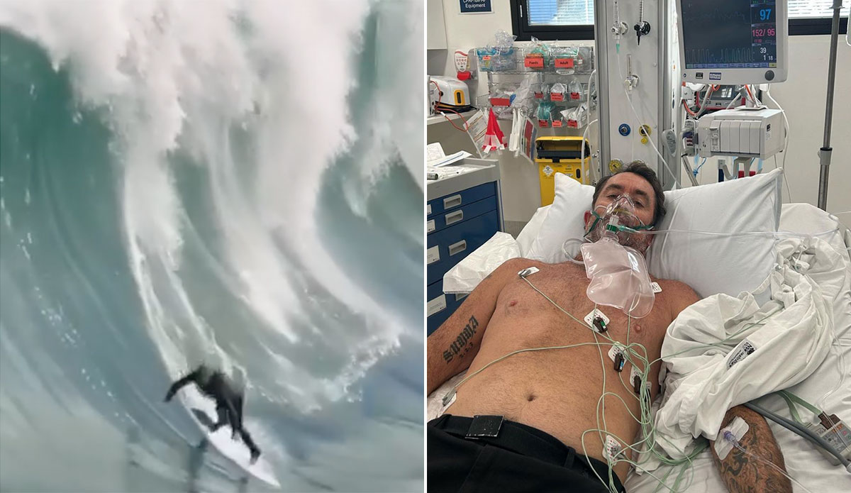 Dylan Longbottom Needs Surgery to Fix the Damage From This Shipstern Bluff Wipeout - Vimarsana News