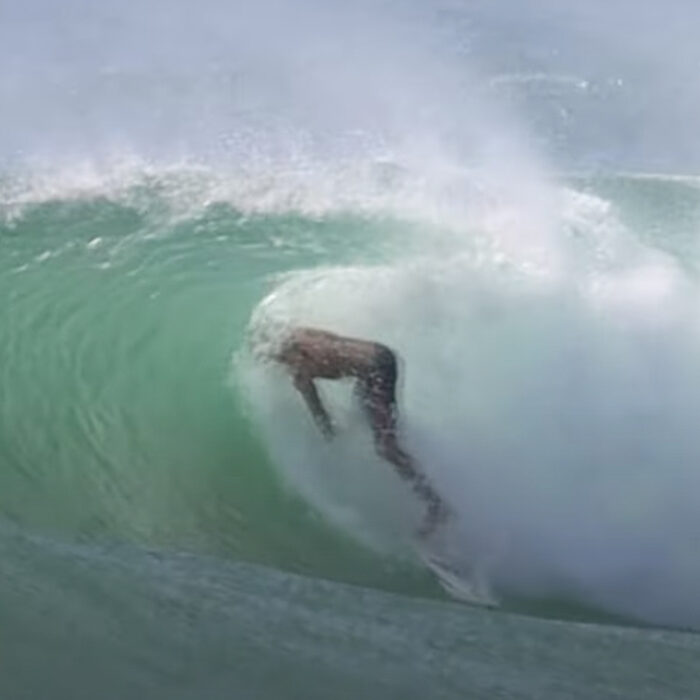 South Straddie surfer gets a board to his face.