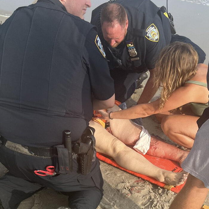 Woman bitten by shark at Rockaway Beach.