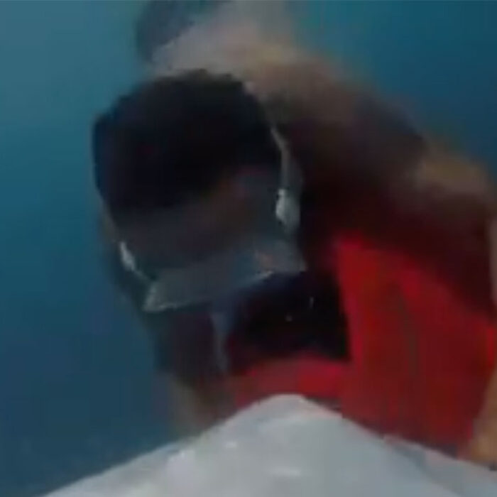 sea scooter surfer collision