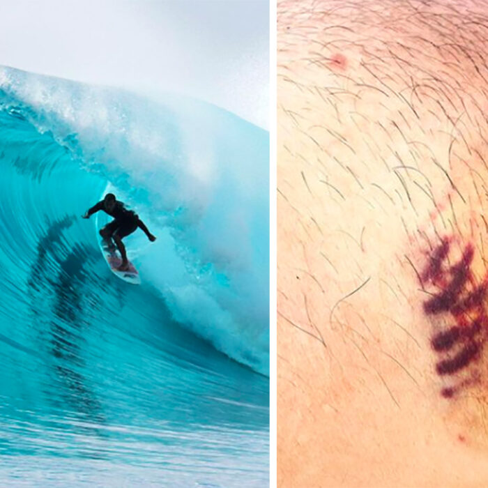 Soli Bailey Almost Left Indonesia with One Nipple Following Accident in Heavy Waves