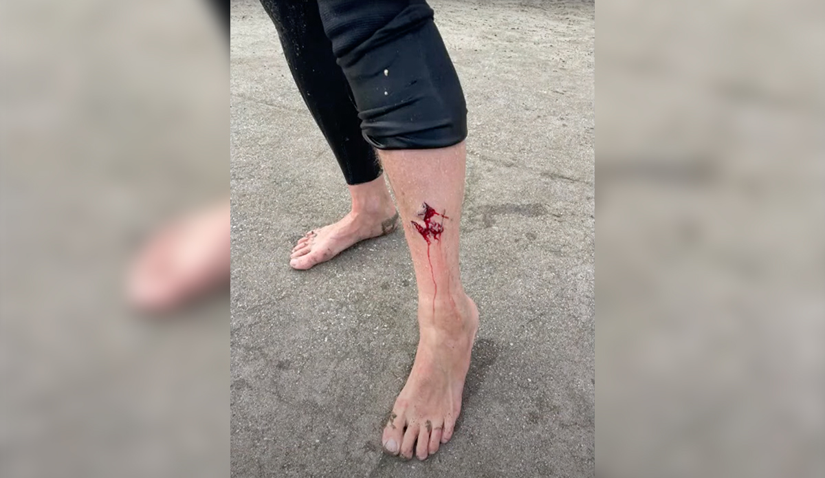 Photo: KTVU // YouTube