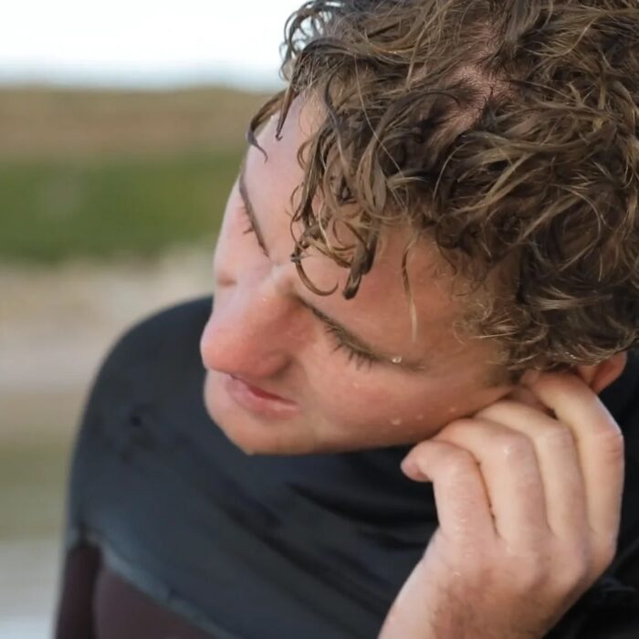 Surfer's Ear: How to Treat and How to Prevent It