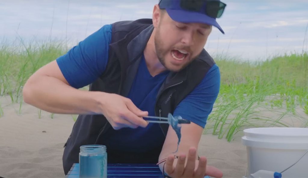 Jellyfish Sting Remedies: Urine Vs. Vinegar on a Portuguese Man O' War ...