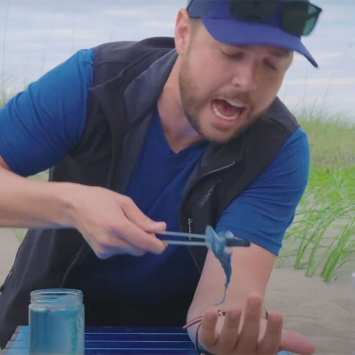 Jellyfish stings
