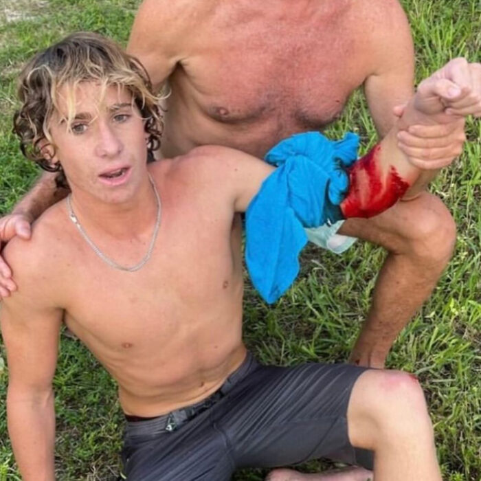 Teddy Wittemann was bitten by a shark while surfing in Brevard County, Florida. Photo: Teddy Wittemann // Instagram