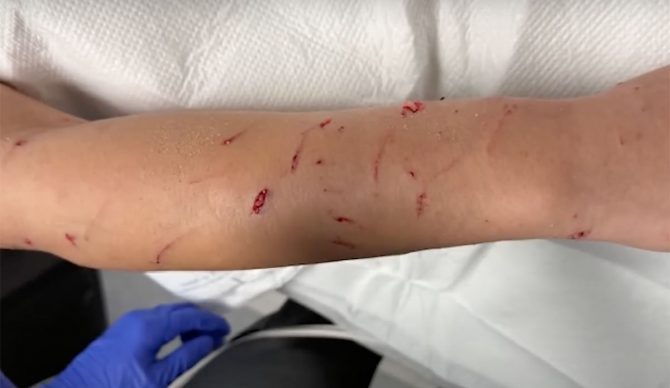 sea lion attacks lifeguard