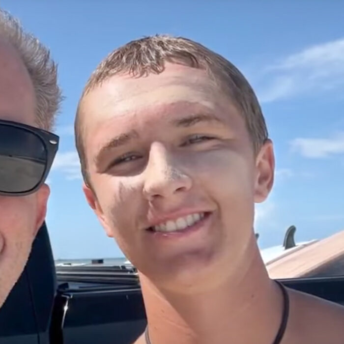 Sam Hollis (right) was bitten on the left foot by a shark. Photo: WESH 2 News
