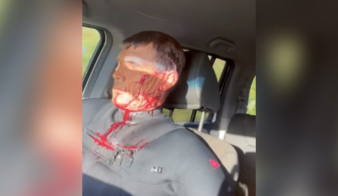 Jamie Mitchell Suffers Gruesome Head Injury Surfing in Hawaii