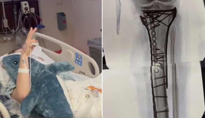 Lindsey Vonn in the hospital after surgery