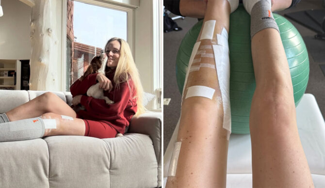 Lindsey Vonn at home recovering from surgery