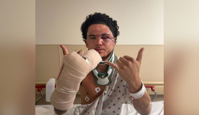 Kekoa Tamale, pictured, was injured by a mob who was attacking a 15-year-old on the North Shore. Photo: Gofundme