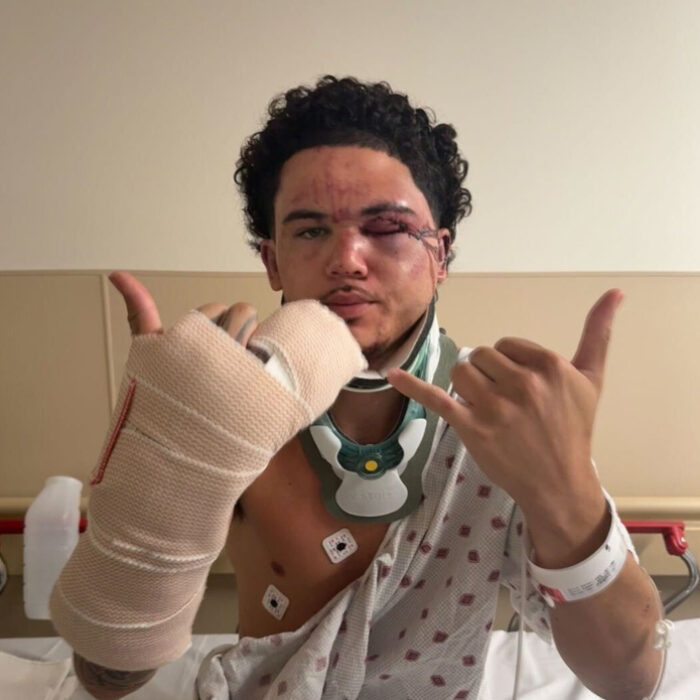 Kekoa Tamale, pictured, was injured by a mob who was attacking a 15-year-old on the North Shore. Photo: Gofundme