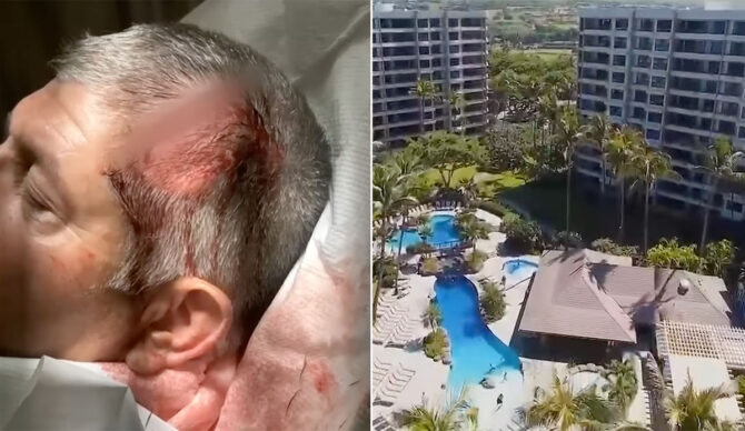 A victim of a brawl at a resort on Maui