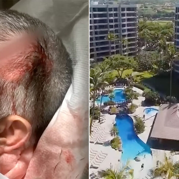 A victim of a brawl at a resort on Maui