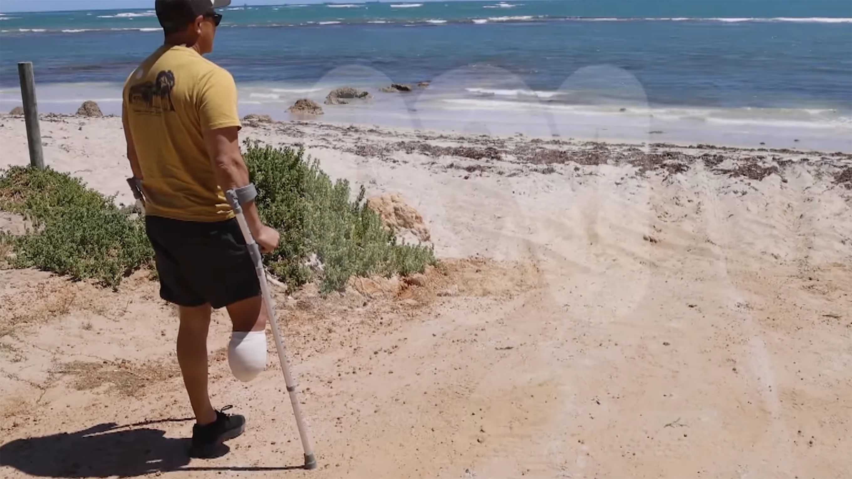 Shark attack survivor Mel Ismail