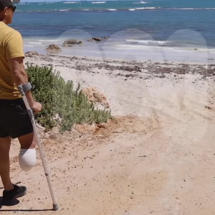 Shark attack survivor Mel Ismail